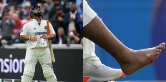 चोट के बाद ऋषभ पंत की वापसी हुई तय, इस दिन मुकाबले खेलते नजर आएंगे स्टार विकेटकीपर Rishabh Pant Injury