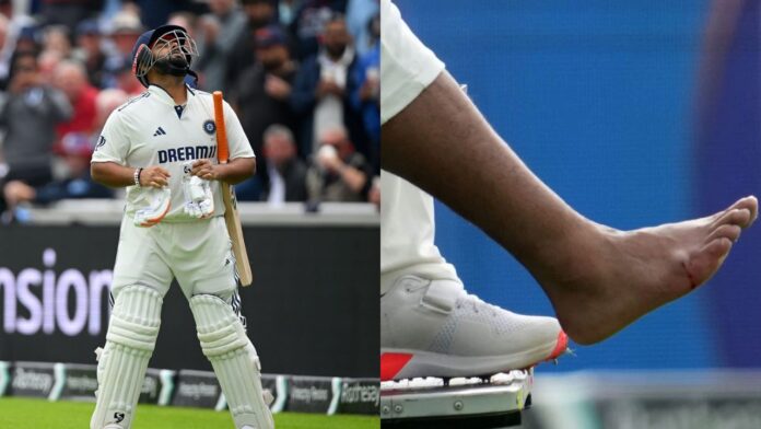 Rishabh Pant Injury Rishabh Pant Injury