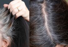 बचपन में ही बाल सफेद होने का क्या है कारण, जानें इसका सही उपाय