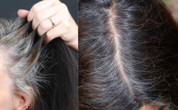 बचपन में ही बाल सफेद होने का क्या है कारण, जानें इसका सही उपाय