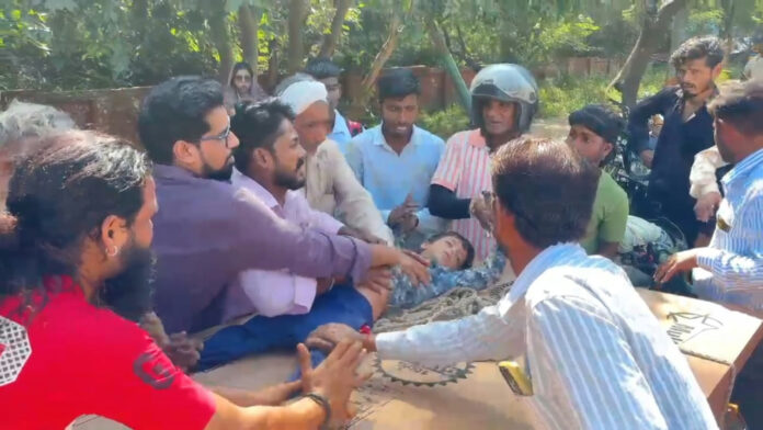 हाईटेंशन लाइन का अर्थ वायर टूटकर बच्चे पर गिरा, गंभीर हालत में आगरा रेफर